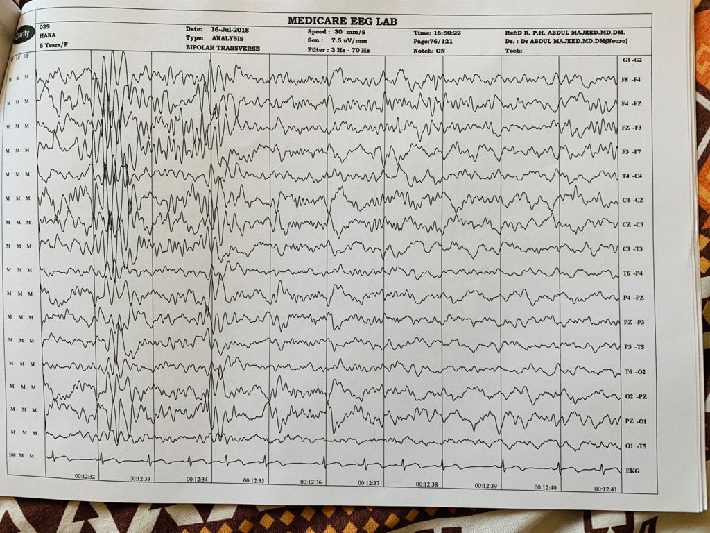 Patient Story